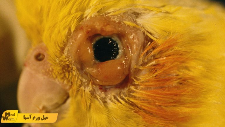 بیماری سل در عروس هلندی